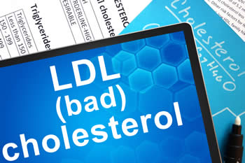 Hoge cholesterol verlagen